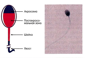 Лечение мужского бесплодия в Москве