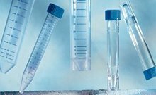 Гиперспермия что это такое. gipospermia 3. Гиперспермия что это такое фото. Гиперспермия что это такое-gipospermia 3. картинка Гиперспермия что это такое. картинка gipospermia 3. Спермограмма с морфологией + MAR-тесты